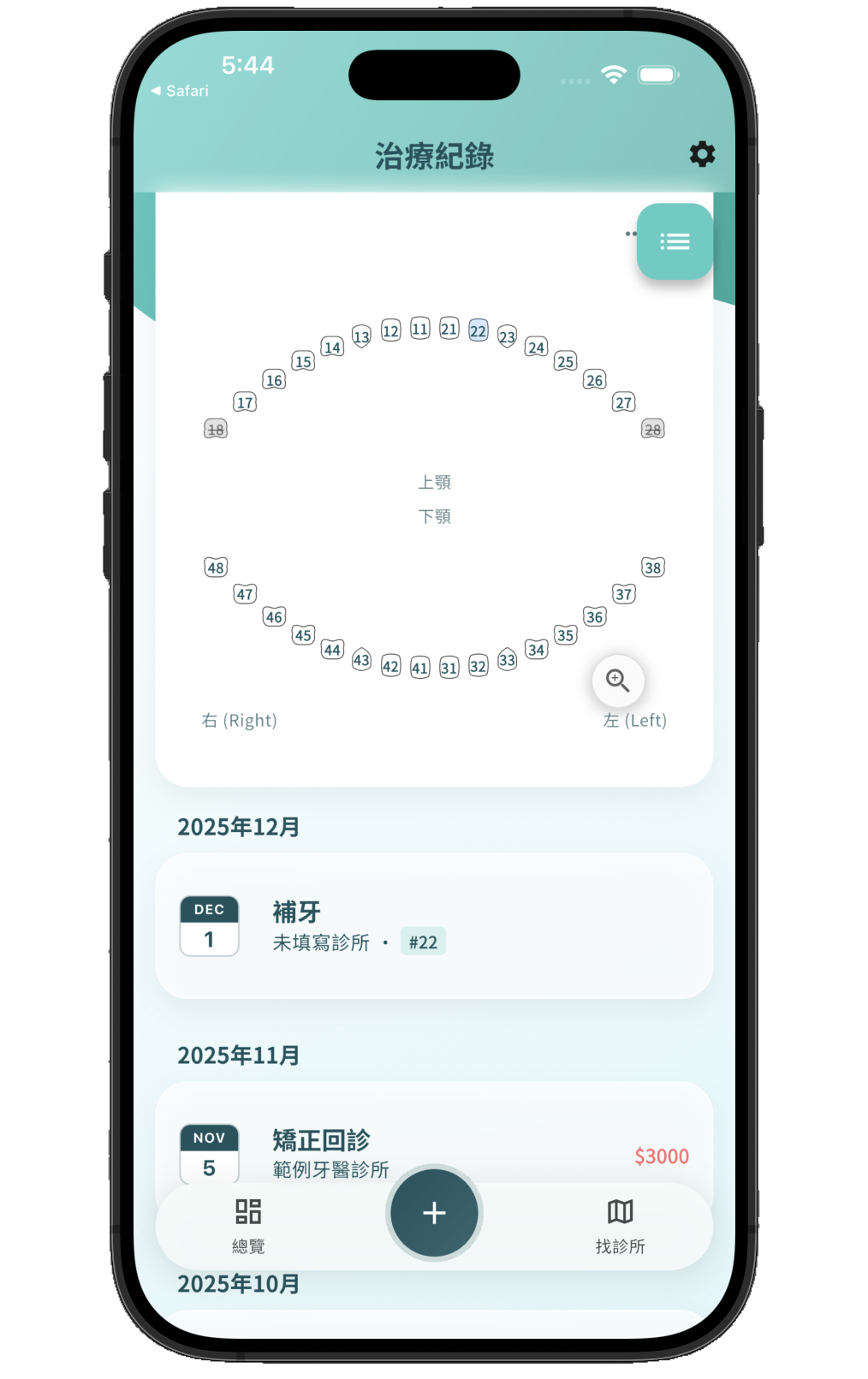 牙齒視覺化工具 - 專業 FDI 牙位紀錄與隱適美進度標記